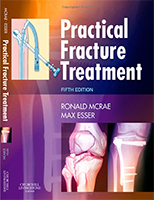 Practical Fracture Treatment 5e